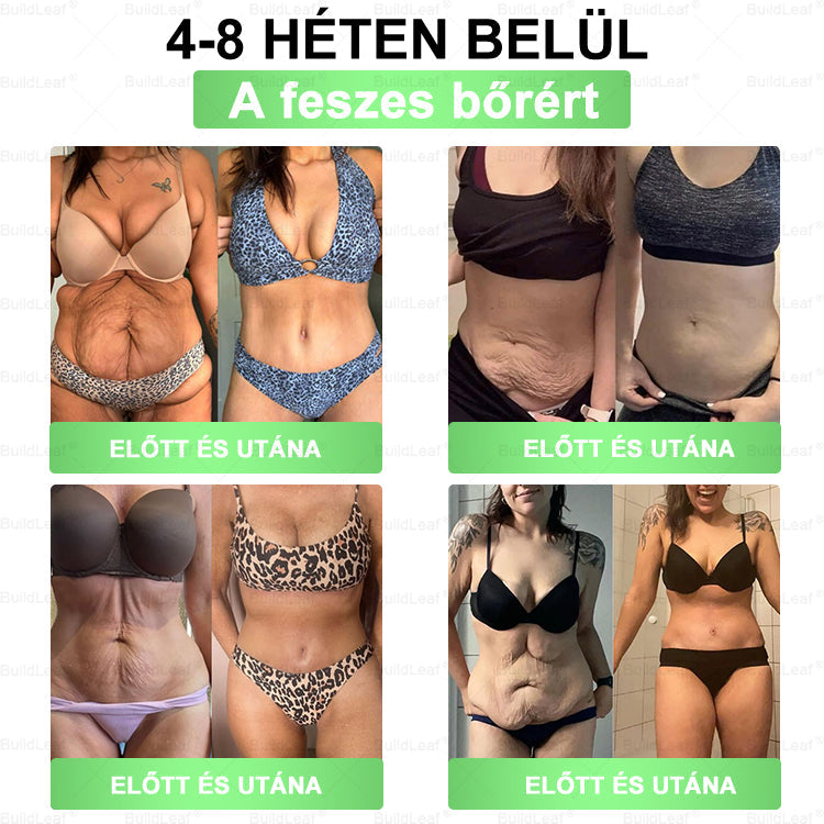 𝐂𝐄 𝐭𝐚𝐧ú𝐬í𝐭𝐯á𝐧𝐲 | 𝐁𝐮𝐢𝐥𝐝𝐋𝐞𝐚𝐟® 𝐆𝐋𝐏-𝟏 𝟖 𝐚𝐳 𝟏-𝐛𝐞𝐧 𝐎𝐫á𝐥𝐢𝐬 𝐎𝐥𝐝𝐚𝐭 ✅𝐓á𝐦𝐨𝐠𝐚𝐭𝐣𝐚 𝐚 𝐟𝐨𝐠𝐲á𝐬𝐭, 𝐚 𝐬𝐳í𝐯- é𝐬 𝐛é𝐥𝐫𝐞𝐧𝐝𝐬𝐳𝐞𝐫𝐢 𝐞𝐠é𝐬𝐳𝐬é𝐠𝐞𝐭, 𝐟𝐞𝐬𝐳𝐞𝐬í𝐭𝐢 𝐚 𝐛ő𝐫𝐭 é𝐬 𝐧ö𝐯𝐞𝐥𝐢 𝐚𝐳 𝐞𝐧𝐞𝐫𝐠𝐢á𝐭.