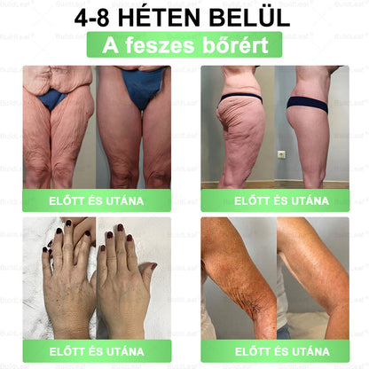 🌱 Vedd kezedbe az egészséged! Csak pár doboz elérhető! 💚 50% kedvezmény a készlet erejéig! 🏃‍♀️ Indítsd el a fogyásod most!