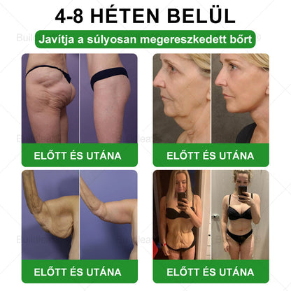 🎉 Siess! Már csak 5 doboz maradt! 🕔 Most extra 50% kedvezményt kínálunk! 💥 Tedd meg az első lépést az egészséges életmód felé, ha ma elszalasztod, csak jövőre lesz következő esélyed!