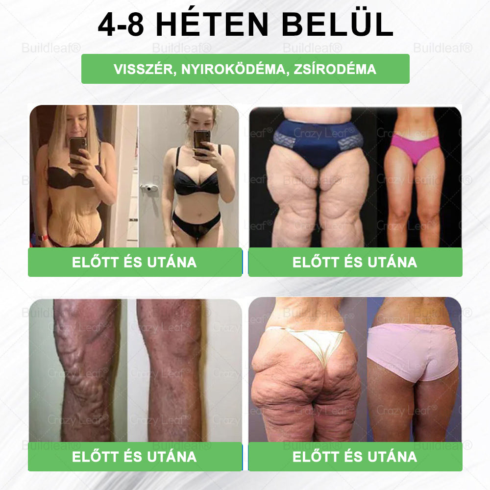 🎉 Siess! Már csak 5 doboz maradt! 🕔 Most extra 50% kedvezményt kínálunk! 💥 Tedd meg az első lépést az egészséges életmód felé, ha ma elszalasztod, csak jövőre lesz következő esélyed!