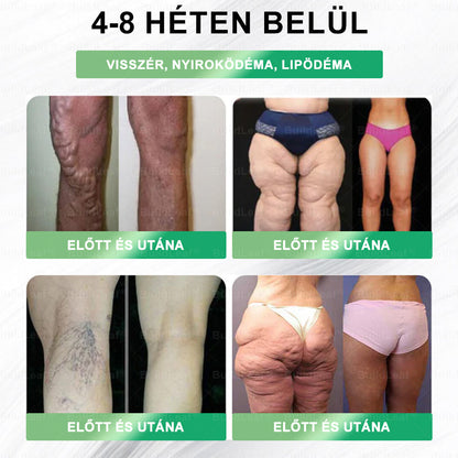 𝐌𝐚𝐠𝐲𝐚𝐫 𝐠𝐲á𝐫𝐭á𝐬ú|𝐁𝐮𝐢𝐥𝐝𝐋𝐞𝐚𝐟® 𝐆𝐋𝐏-𝟏 𝟖-𝐢𝐧-𝟏 𝐅𝐢𝐭 & 𝐕𝐢𝐭𝐚𝐥 𝐒𝐳á𝐣𝐡𝐢𝐠𝐢é𝐧𝐢á𝐢 𝐎𝐥𝐝𝐚𝐭 ✅ 𝐀𝐥𝐤𝐚𝐥𝐦𝐚𝐬 𝐞𝐠é𝐬𝐳𝐬é𝐠, 𝐬𝐳í𝐯- é𝐬 é𝐫𝐫𝐞𝐧𝐝𝐬𝐳𝐞𝐫𝐢 𝐞𝐠é𝐬𝐳𝐬é𝐠, 𝐜𝐮𝐤𝐨𝐫𝐛𝐞𝐭𝐞𝐠𝐬é𝐠, 𝐚𝐥𝐯á𝐬𝐢 𝐚𝐩𝐧𝐨𝐞, 𝐛é𝐥𝐫𝐞𝐧𝐝𝐬𝐳𝐞𝐫𝐢 𝐞𝐠é𝐬𝐳𝐬é𝐠, í𝐳ü𝐥𝐞𝐭𝐢 𝐩𝐫𝐨𝐛𝐥é𝐦á𝐤 é𝐬 𝐞𝐠𝐲é𝐛 𝐞𝐠é𝐬𝐳𝐬é𝐠ü𝐠𝐲𝐢 𝐢𝐠é𝐧𝐲𝐞𝐤 𝐞𝐬𝐞𝐭é𝐧