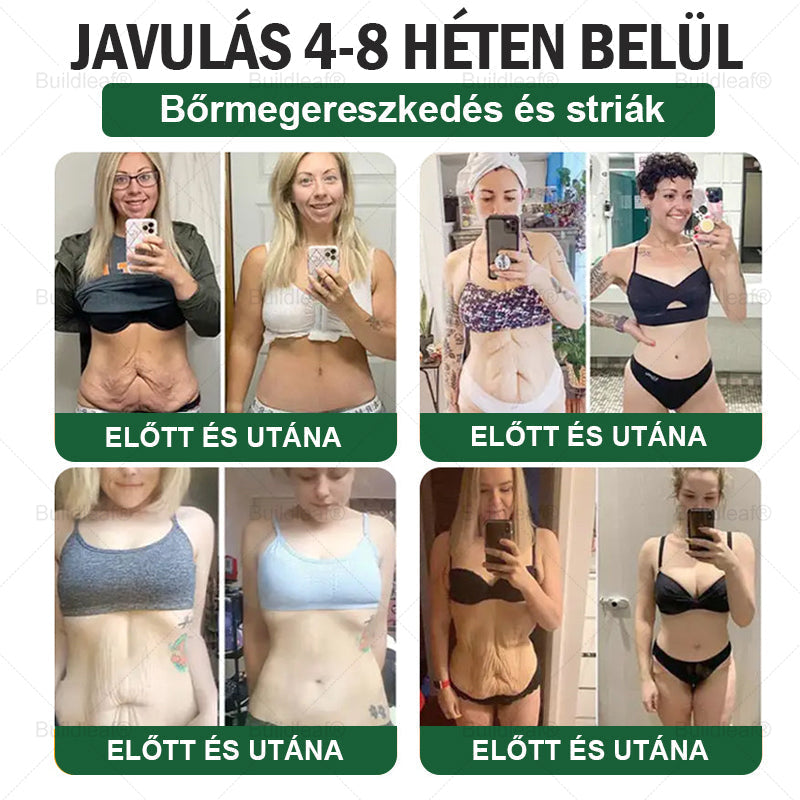 🎉 Siess! Már csak 5 doboz maradt! 🕔 Most extra 50% kedvezményt kínálunk! 💥 Tedd meg az első lépést az egészséges életmód felé, ha ma elszalasztod, csak jövőre lesz következő esélyed!